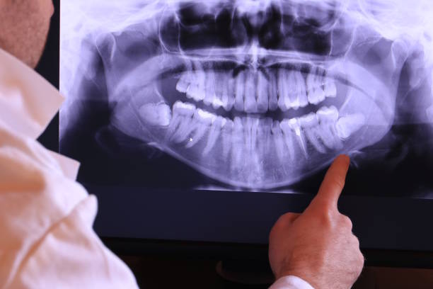 Best Broken or Chipped Tooth Repair in , AR