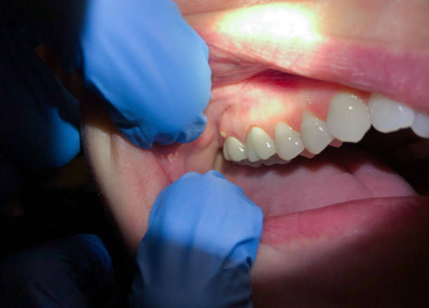 Best Emergency Cosmetic Dentistry (e.g., broken veneers) in , AR